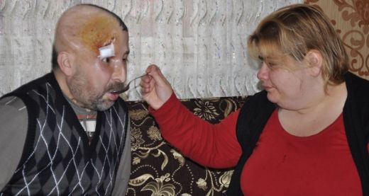 Beyinde Ur Nasıl Tedavi Edilir?